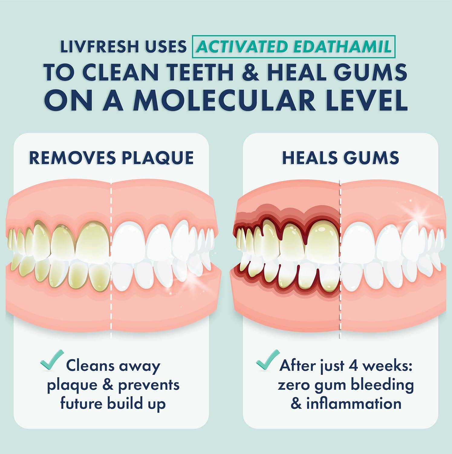 LIVFRESH Toothpaste Gel - SLS Free Dental Gel, Wintergreen